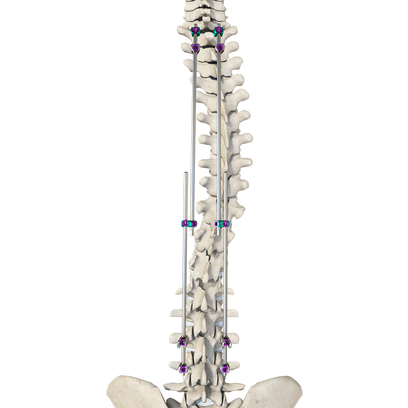 Ultra-Durable Broadband Lamina Hook (4.75 System) -Coccygeal &amp; Spinal Internal Fixation