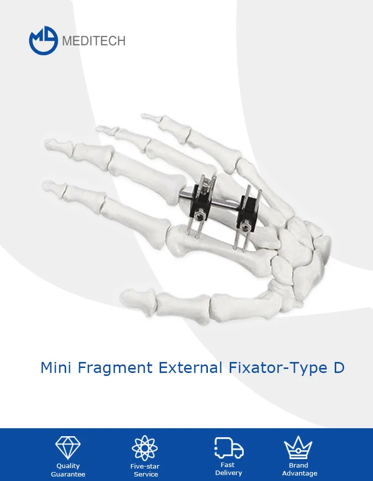 Orthopedic Surgical Instruments