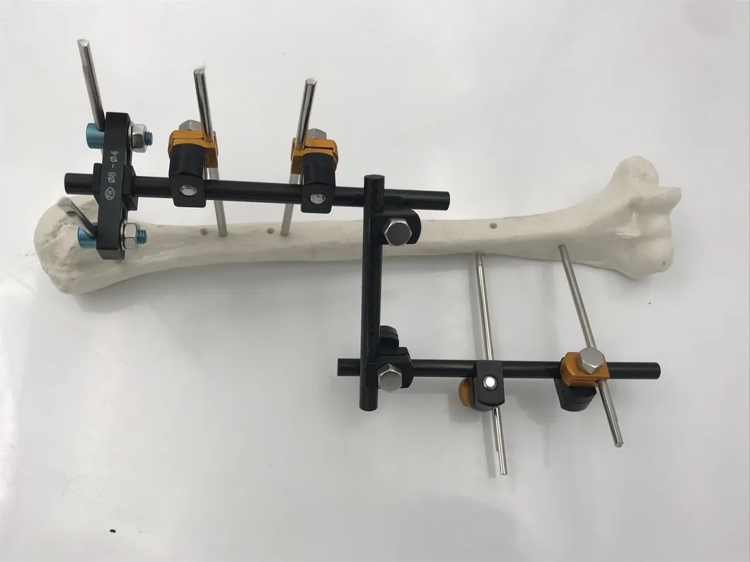 Combination External Fixator