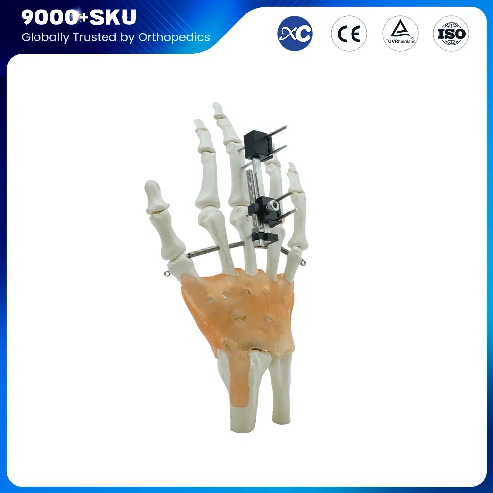 Orthopedic Surgery Trauma Manufacturer Finger External Fixator for Mini Fixator