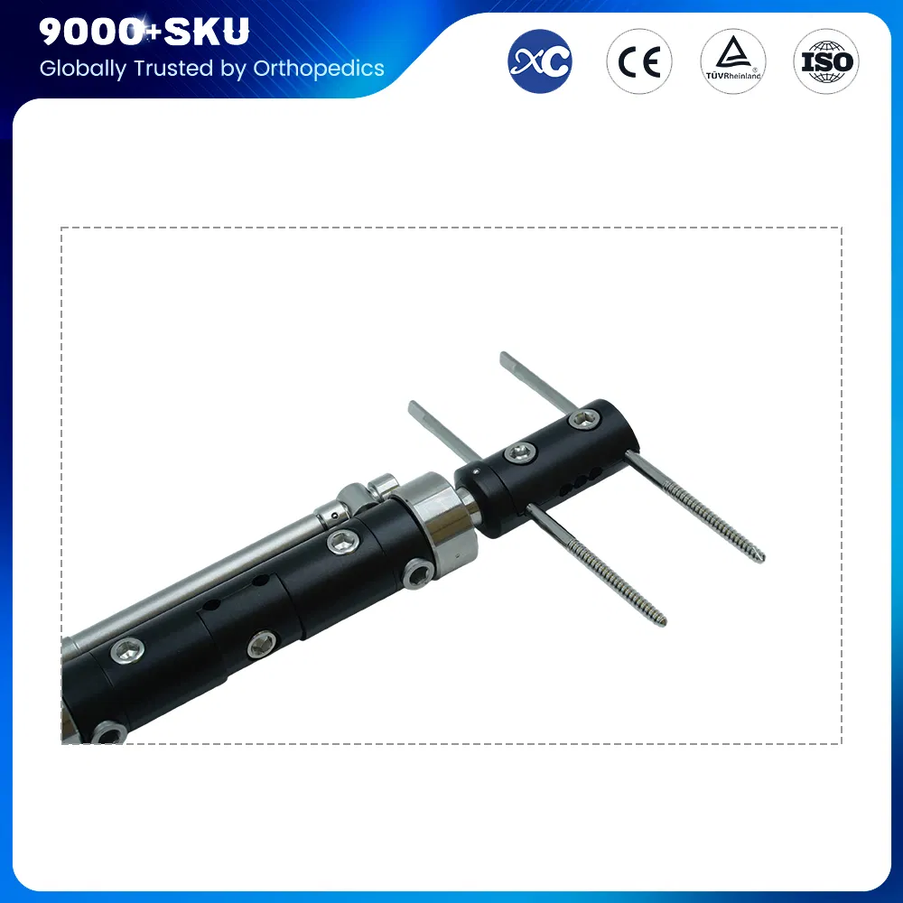 Orthopedic Surgery Trauma Bone Pin Stent Spanning External Fixator for Tibia Femur