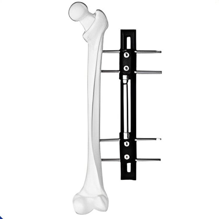 Orthopedic Surgical Mini Combined Type Fragment External Fixator for Fracture Surgery