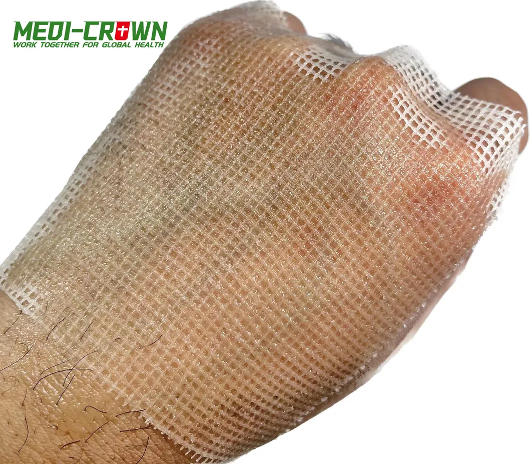 Paraffin Gauze Detail 2