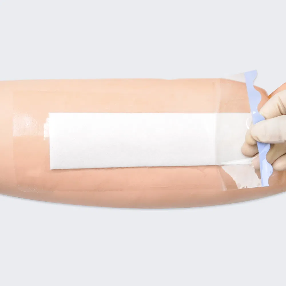 Waterproof Abdominal Incision Bandages Transparent Wound Dressing Self-Adhesive Wound Gauze for C-Section