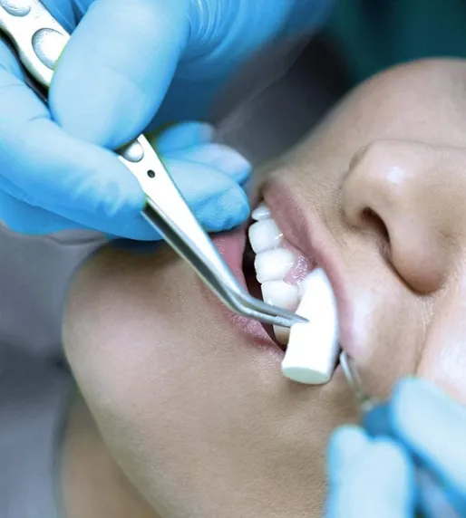 Dental Cotton Rolls View 4