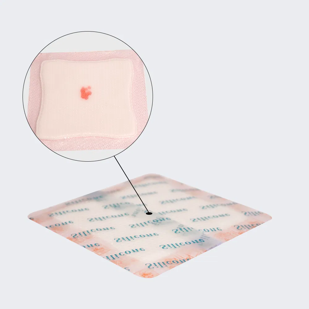 Bordered Foam Dressing