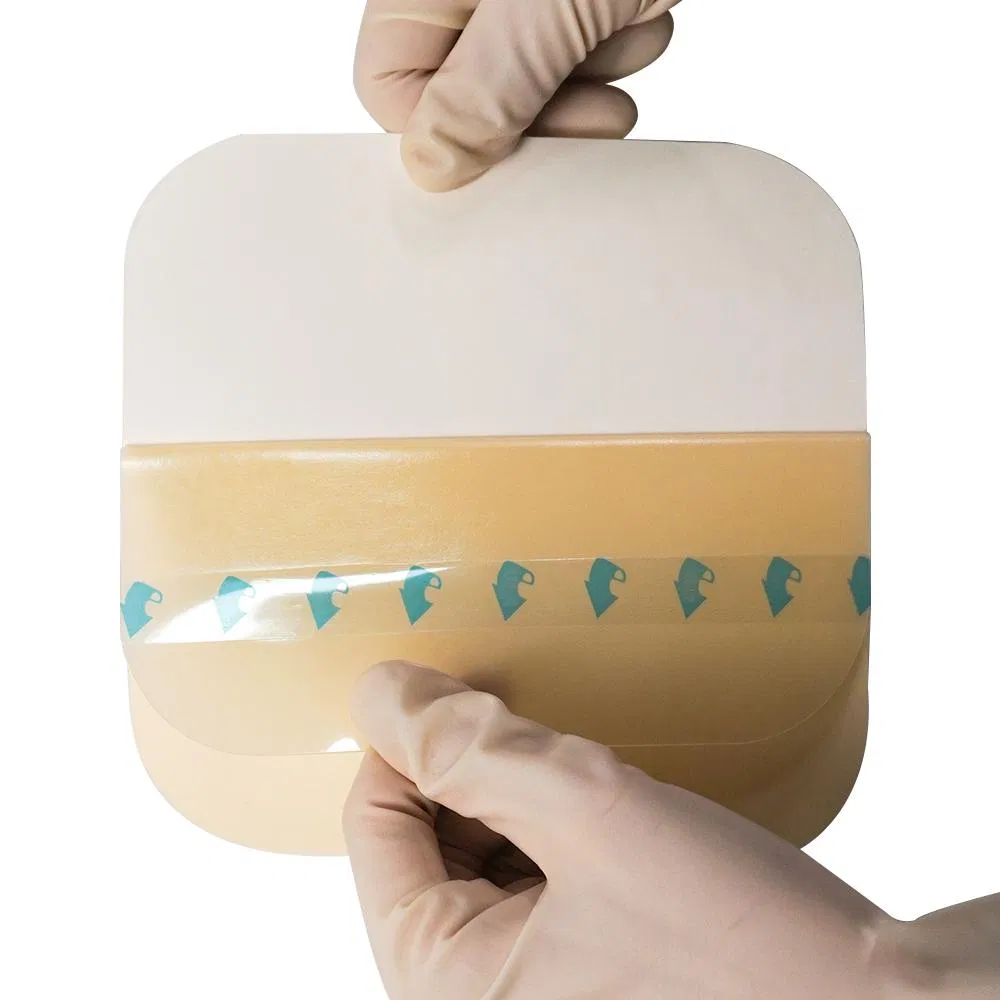 Hydrocolloid Dressing View 2