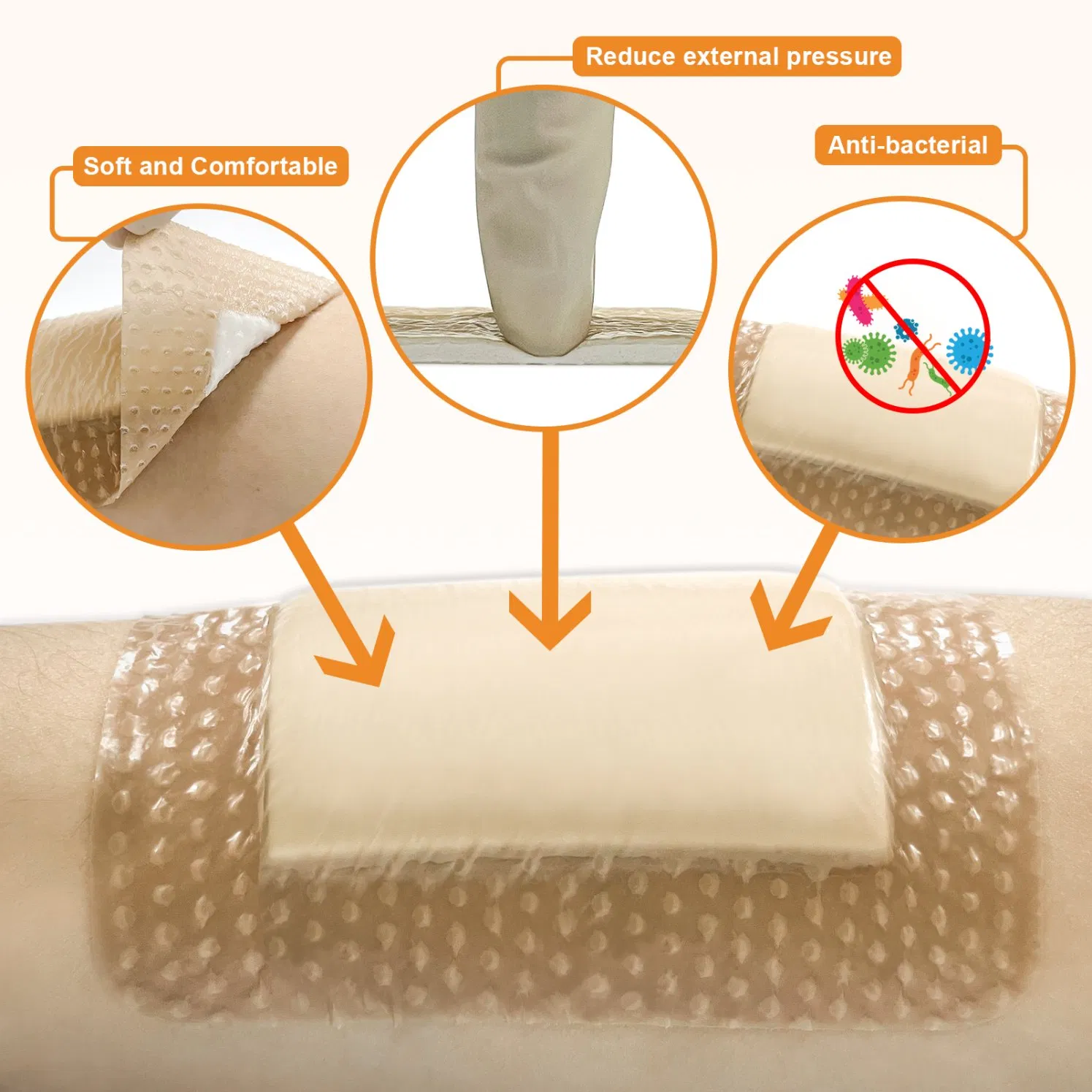 Silicone Foam Dressing for Chronic Wound Healing