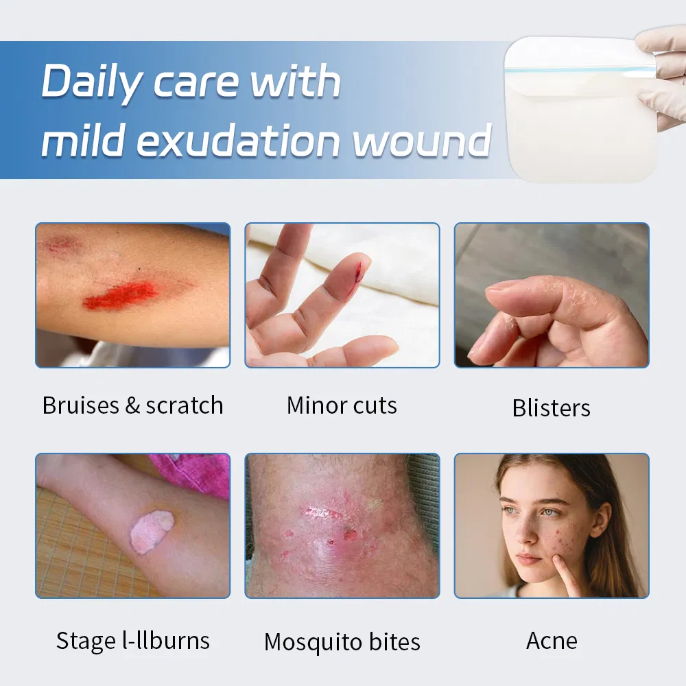 Hydrocolloid Bandages 6