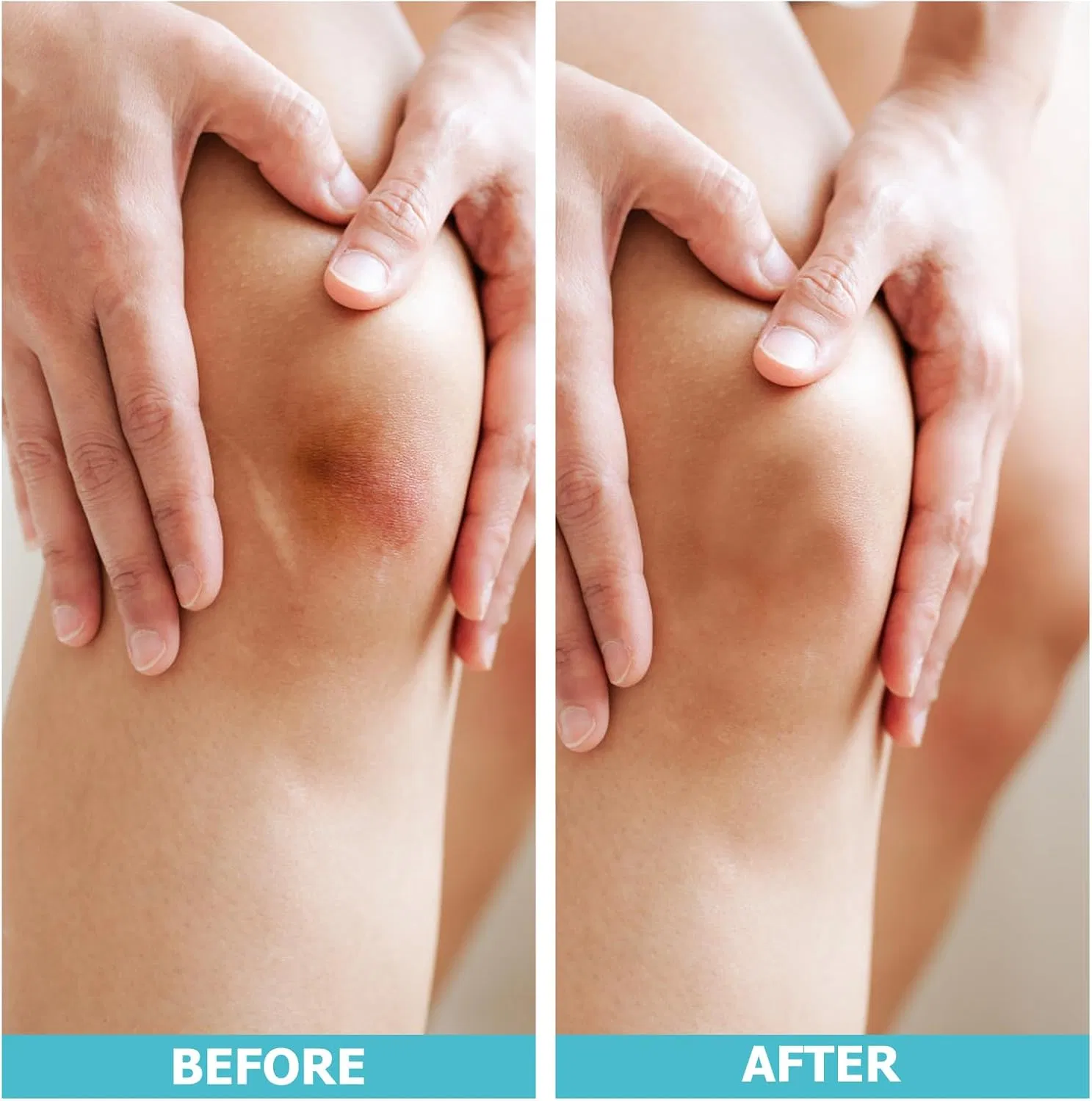 Hydrocolloid Roll Bandage First Aid Kit Essential