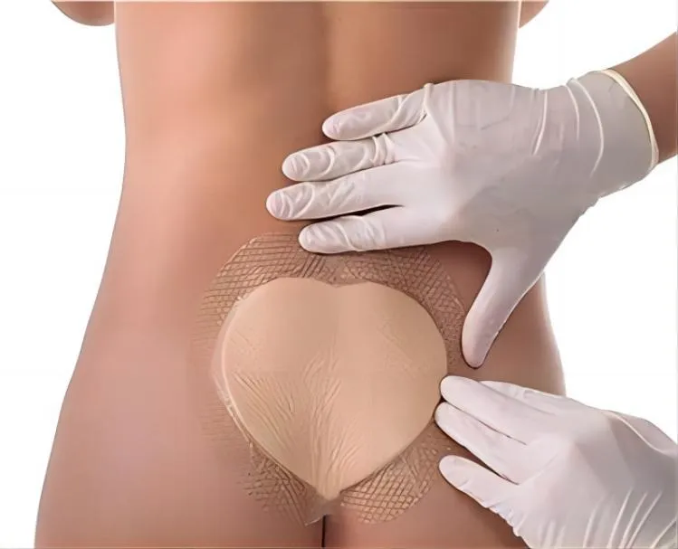 Silicone Foam Dressing Absorbency