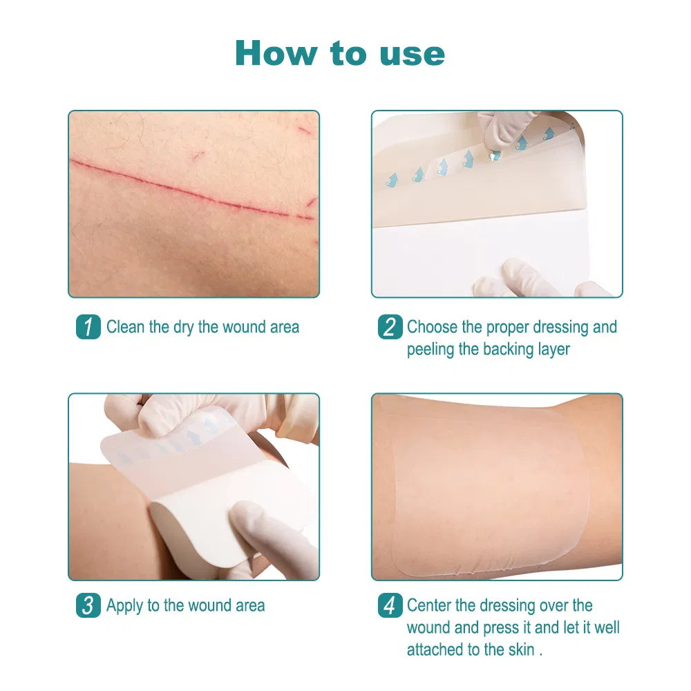 Hydrocolloid Dressing Detail 5