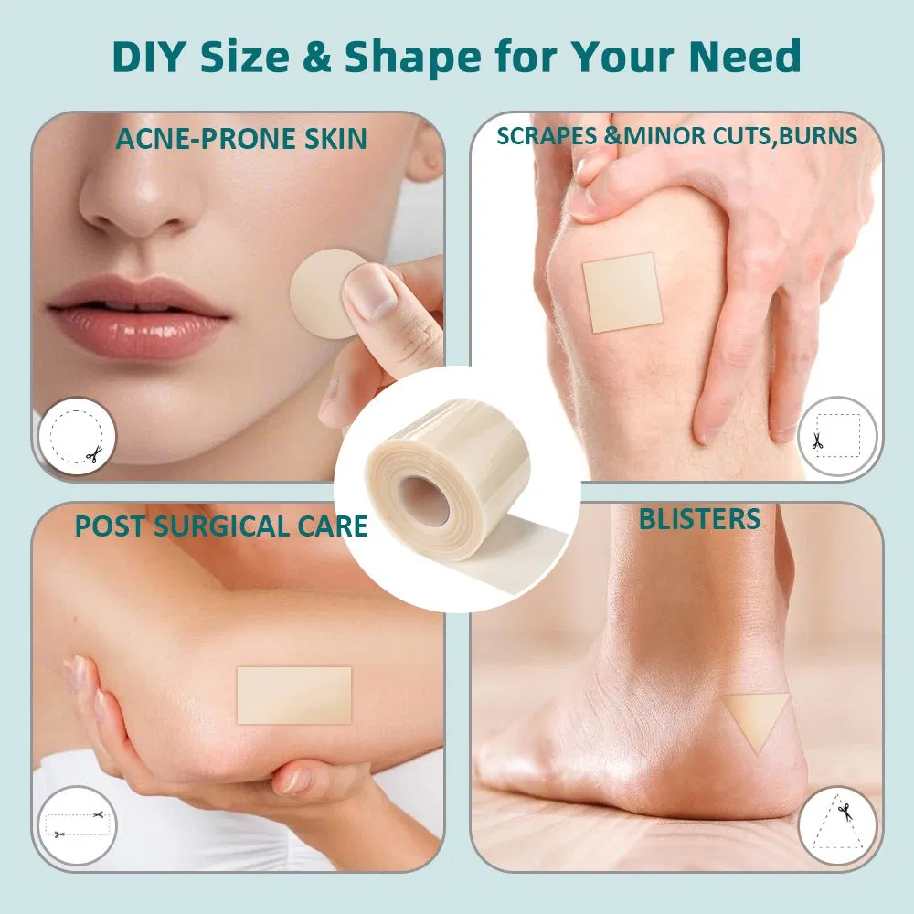 Cuttable Home Hydrocolloid Bandages for Wounds Blister Dressing