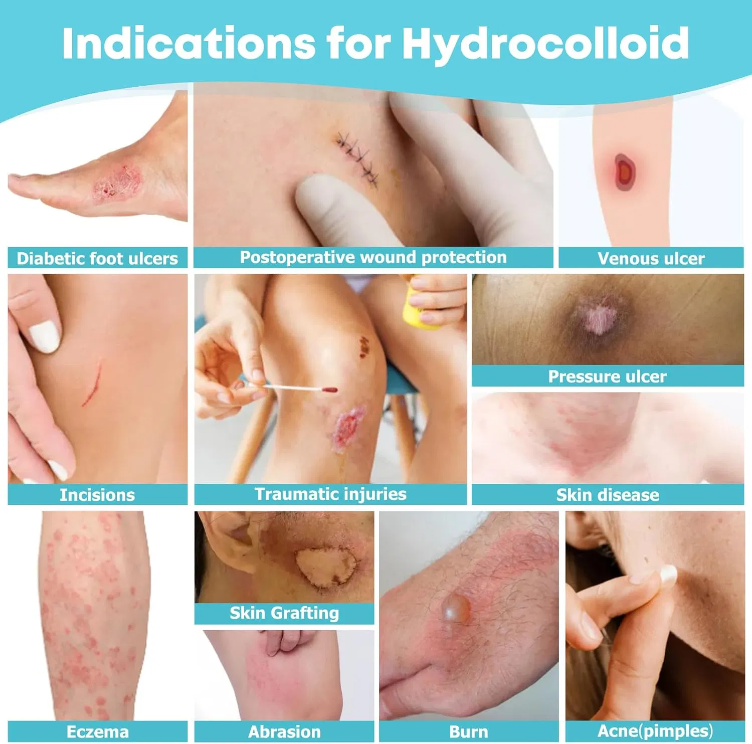 Hydrocolloid Roll Bandage First Aid Kit Essential