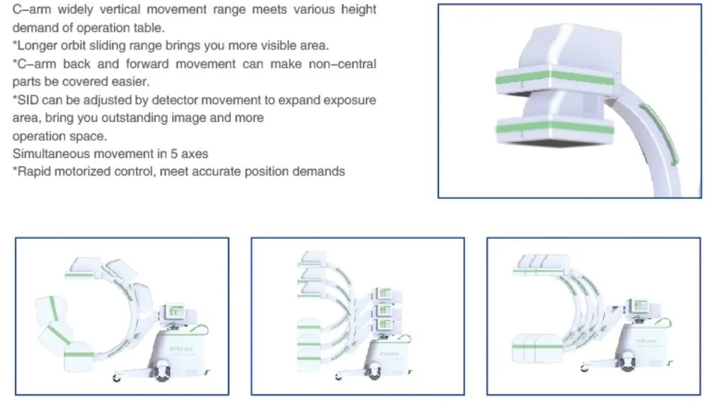 C-Arm System Feature 1