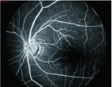 Fundus Camera System 3