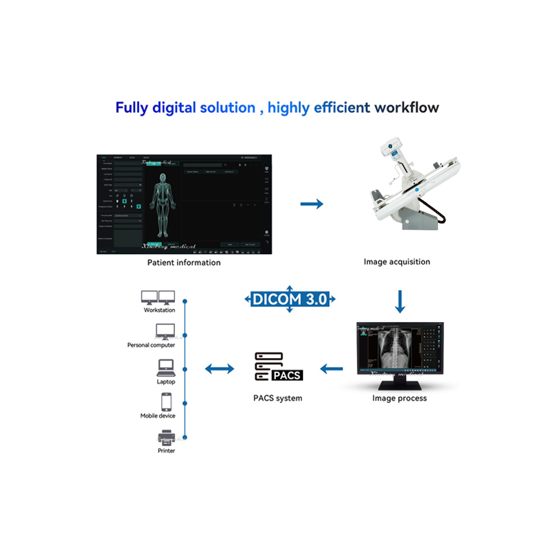 with Cheap Price Urinary System Angiography Drf 1000mA X-ray Machine