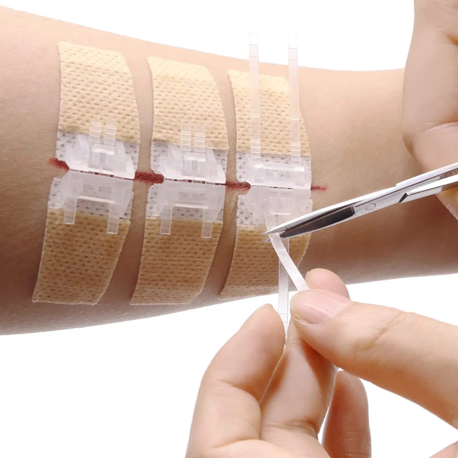 Quick Clot Zip Sutures Laceration Kit Surgical Quality Laceration Repair Kit Without Stitches