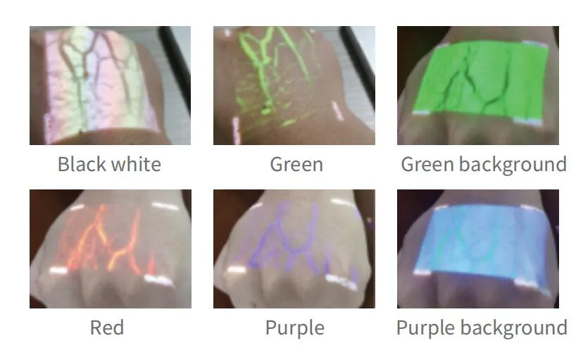 Vein Finder Application 2