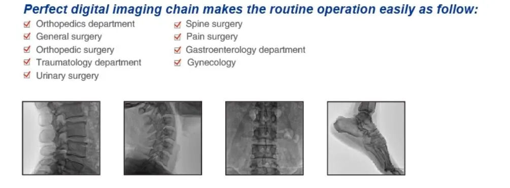 C-Arm System Feature 2