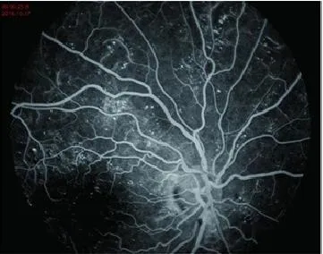 Fundus Camera System 4