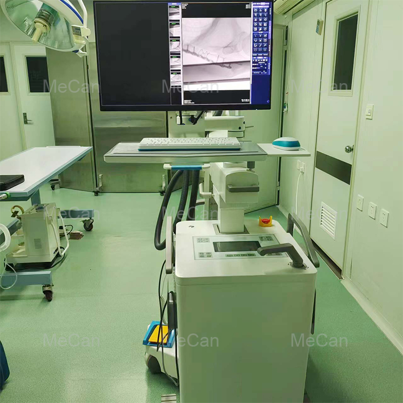5kw C-Arm Xray Medical Angiography Mobile C Arm Fluoroscopy Machine