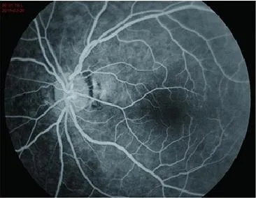 Fundus Camera System 2