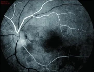 Fundus Camera System 1