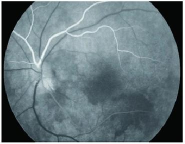 Hospital Ophthalmic Instrument Optical Fundus Camera Fluorescein Angiography System