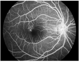 Hospital Ophthalmic Instrument Optical Fundus Camera Fluorescein Angiography System
