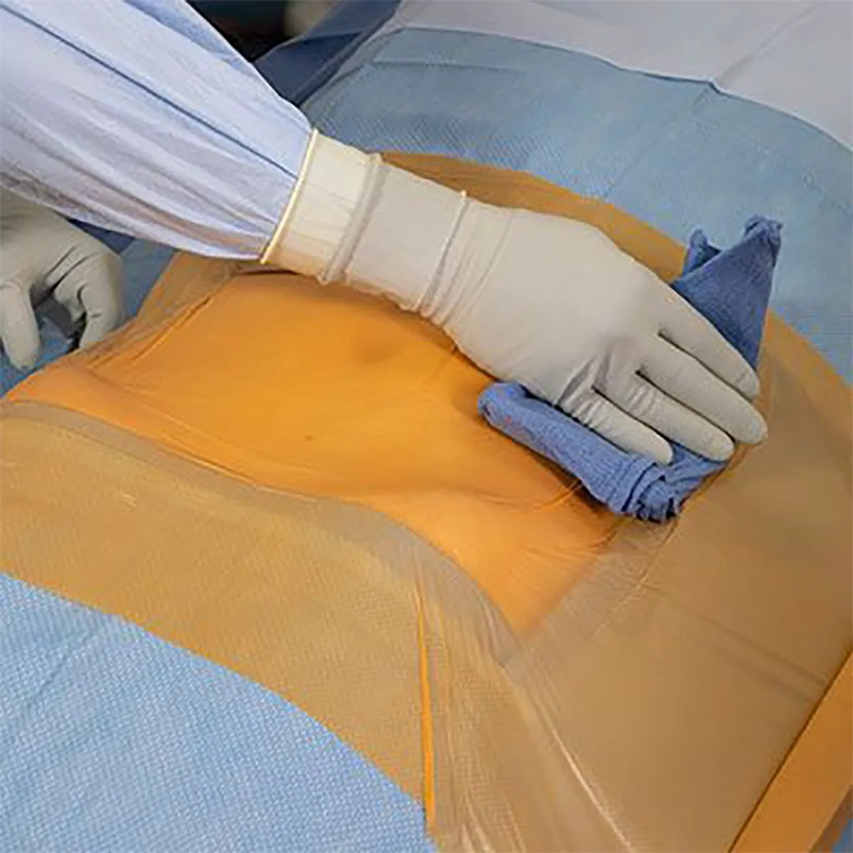 Surgical Incise Dressing Drape with Iodine