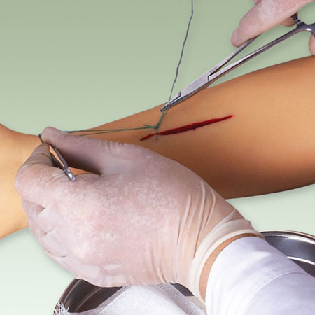 Siny Sterile Surgical Supplies Nylon Suture Suturing Kit