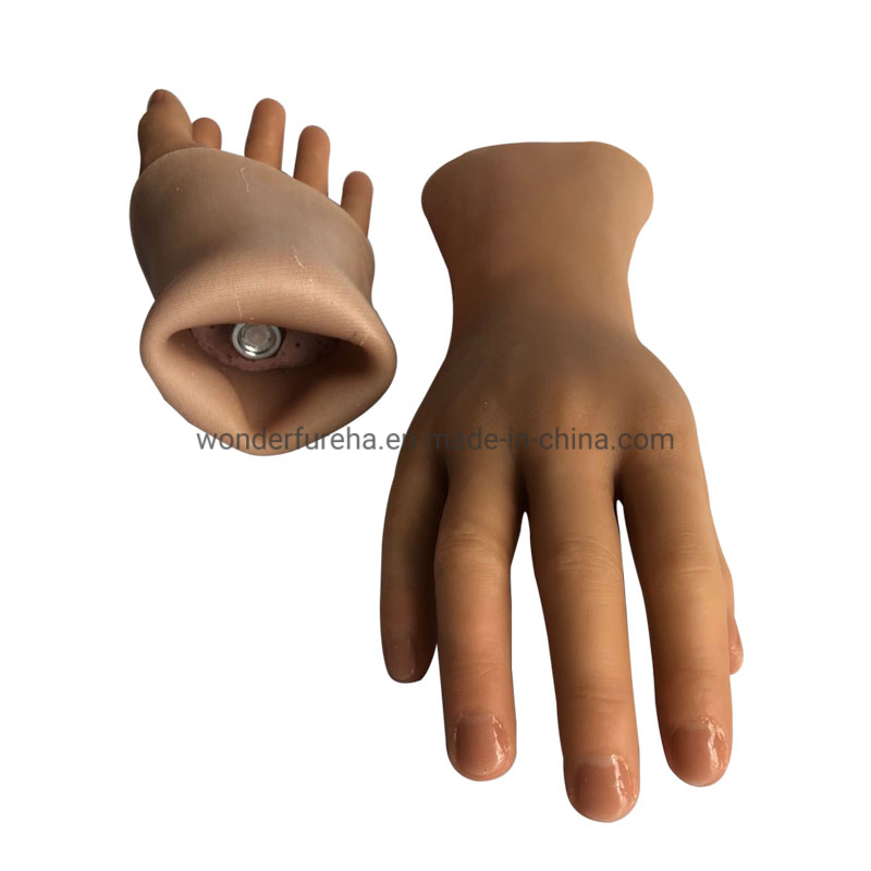 Mão protética, implantes ortopédicos, próteses médicas, mão artificial, luva de silicone