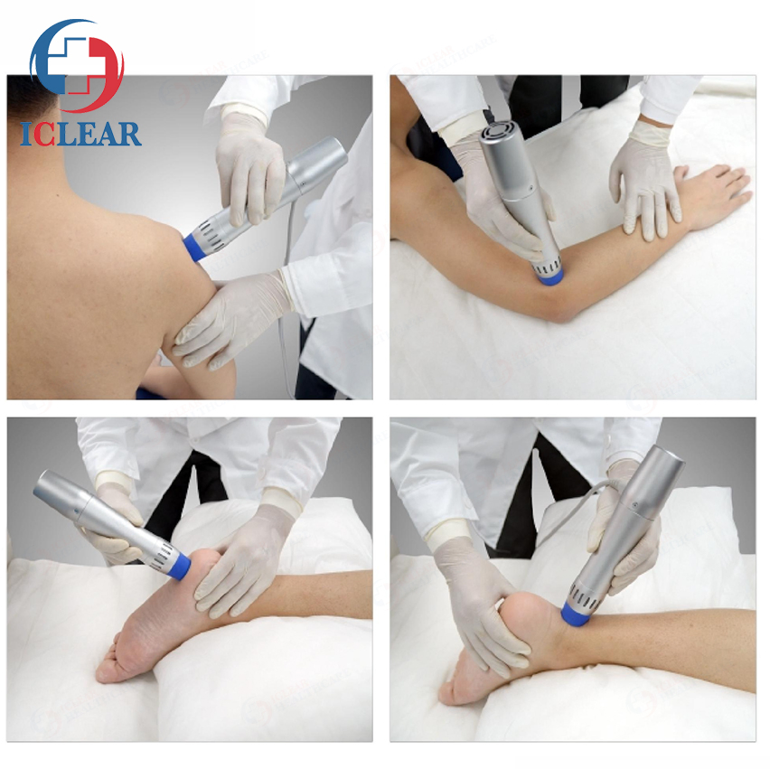 0-5bar Electromagnetic Ballistic Radial Eswt Shock Wave Sports Rehabilitation Equipment for Chronic Pain