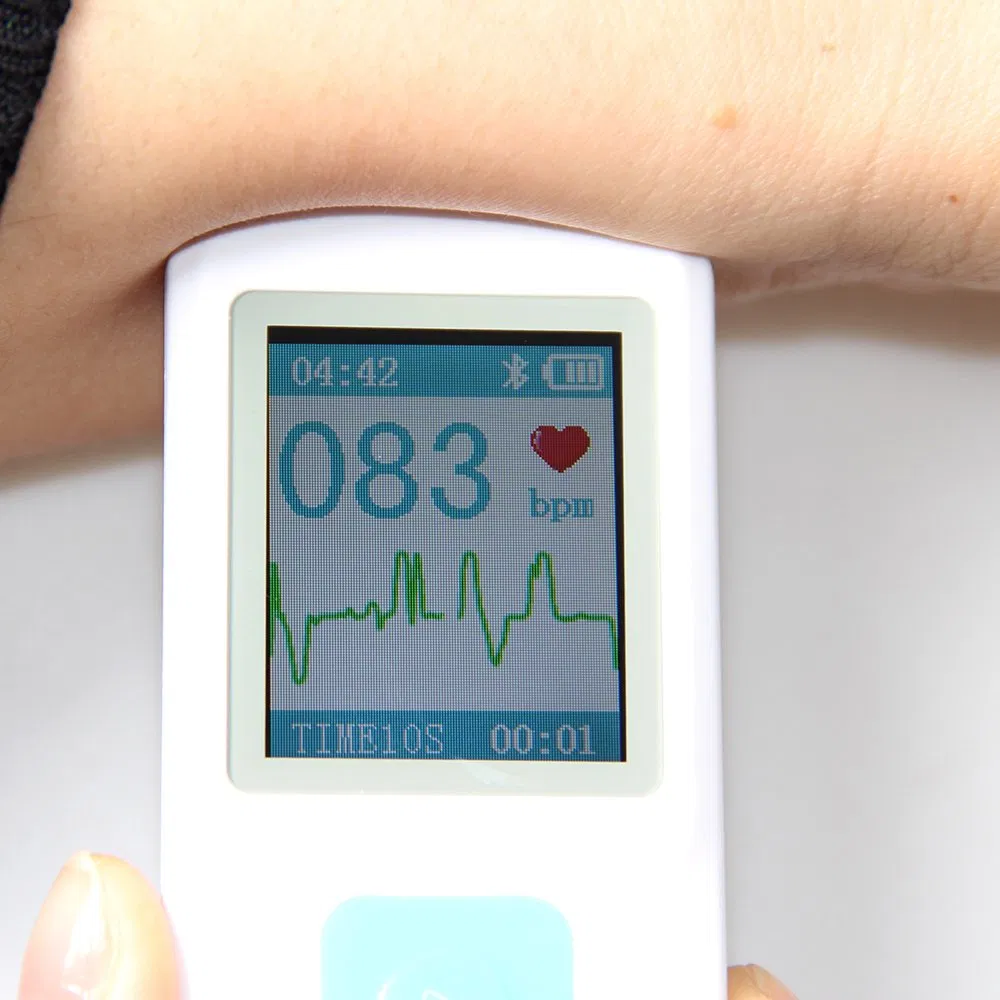 Contec Portable ECG Monitor Pm10 Mini ECG Machine Wireless ECG Monitor