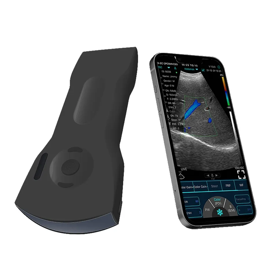 Handheld Ultrasound Device