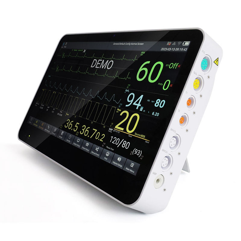 Advanced Smart Vital Sign Monitor for Remote Health Tracking