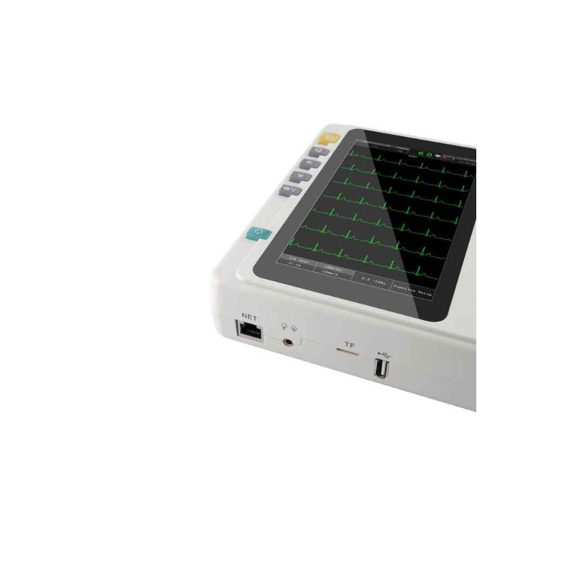 Advanced Compact ECG Machine with 6-Lead Monitoring Features