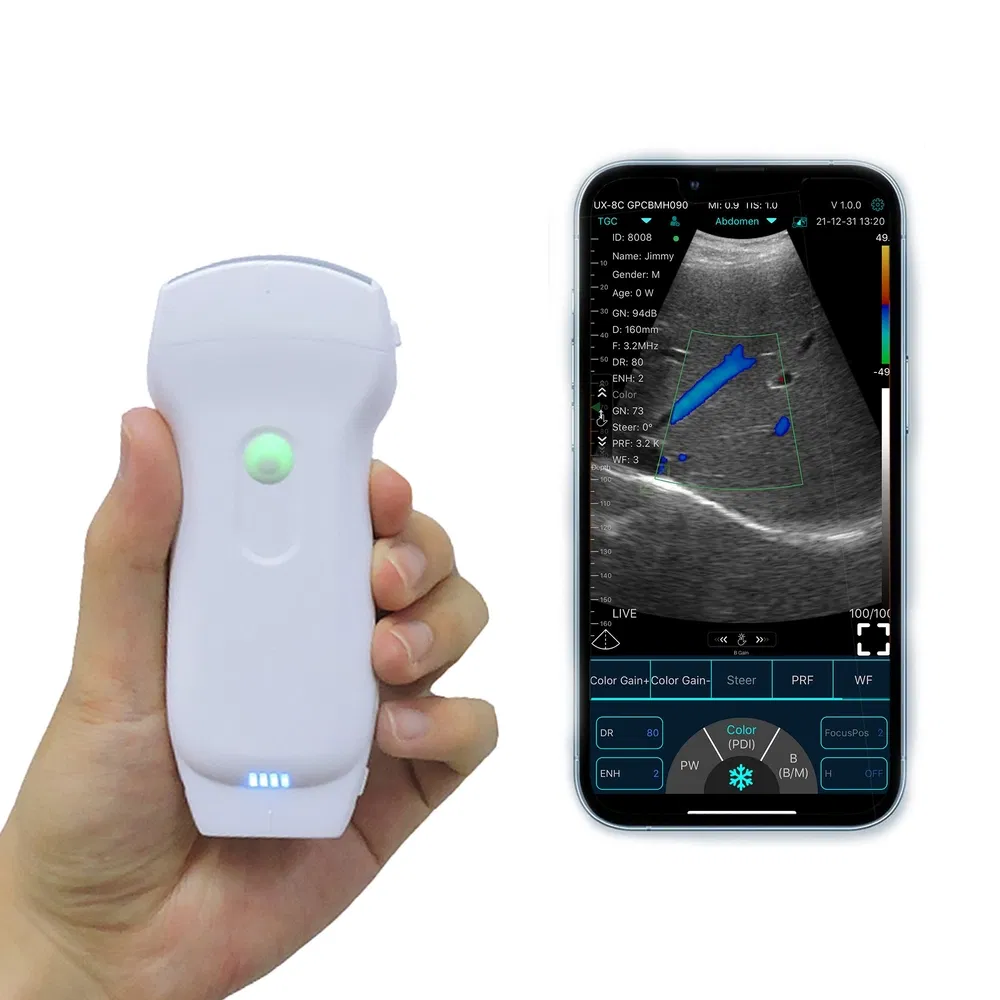 Hybrid-Design Handheld Multi-Depth Convex-Linear Combined Ultrasound Probe for Cardiac Echocardiography Studies