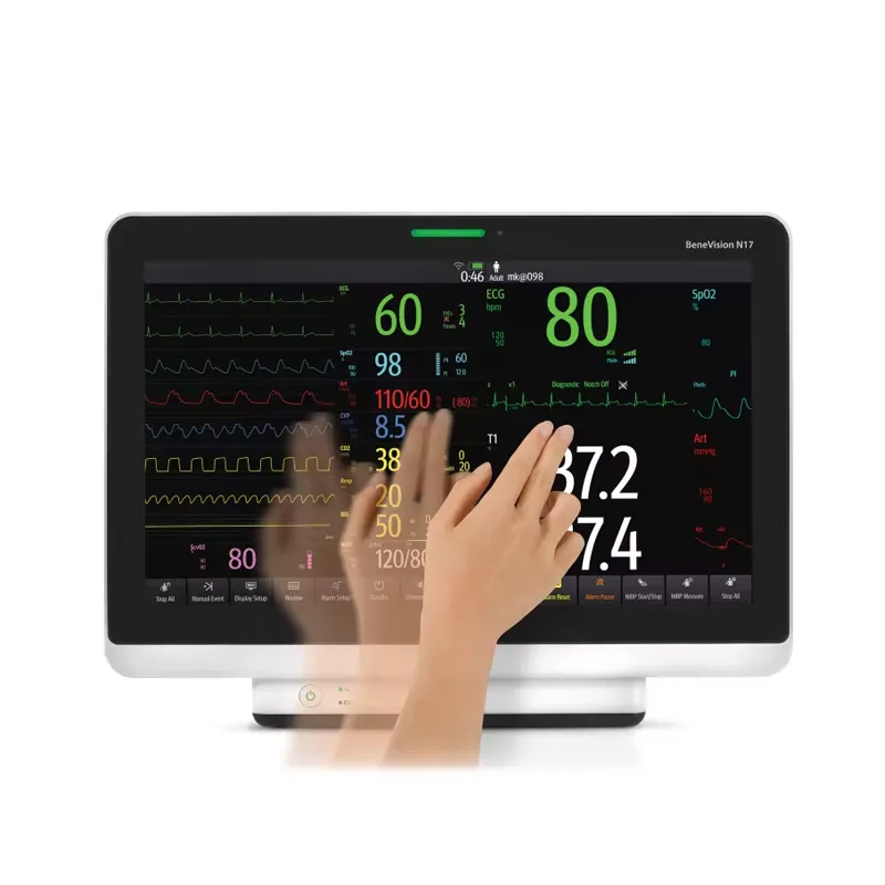 Patient Monitor 5