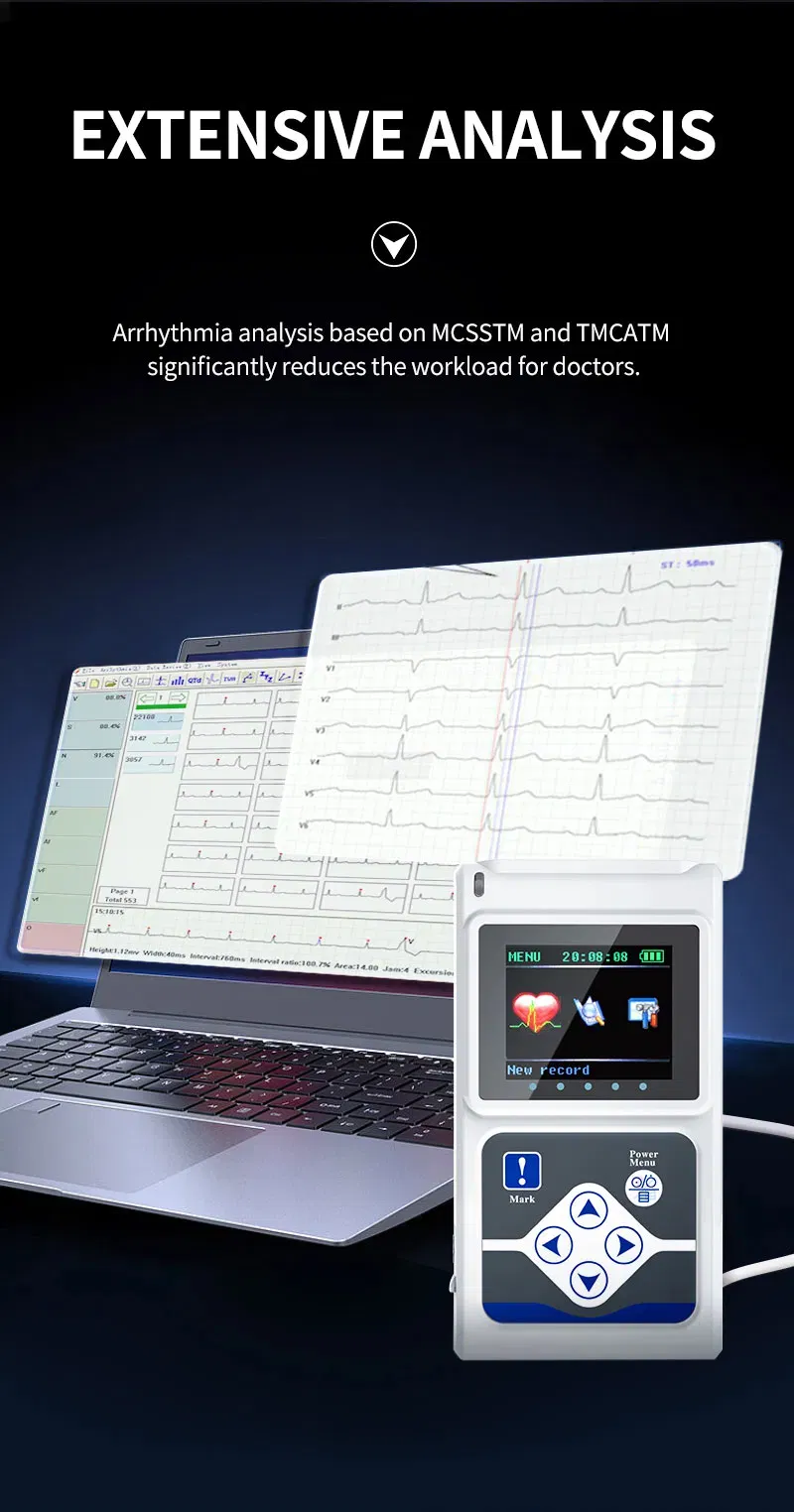 ECG Tracking System