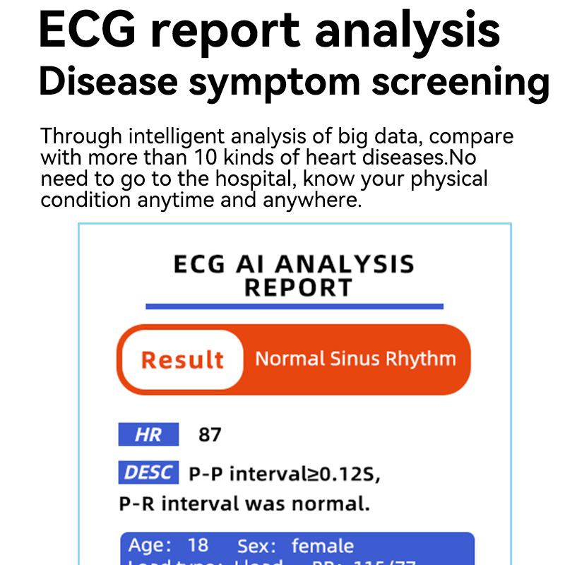 Smart Watch Non-Invasive Blood Glucose Uric Acid Blood Lipid Measurement ECG Temperature Call Wearable Device Smartwatch