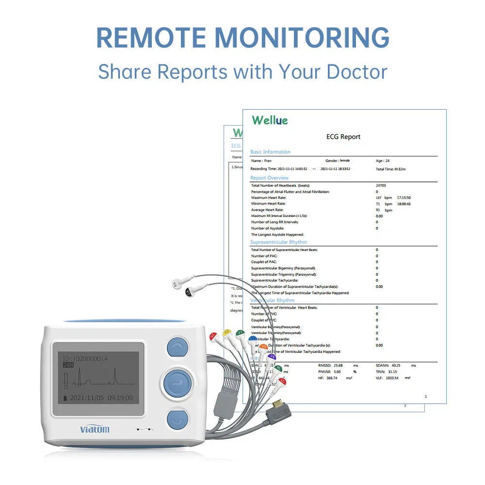 Portable 24-Hour 12-Lead ECG Holter Monitor