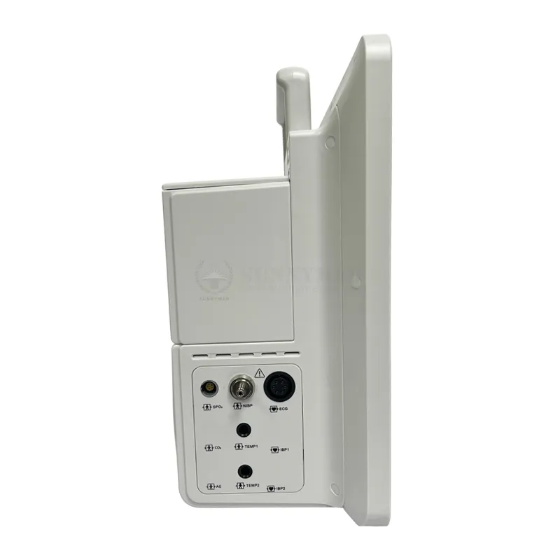 Side View Ports