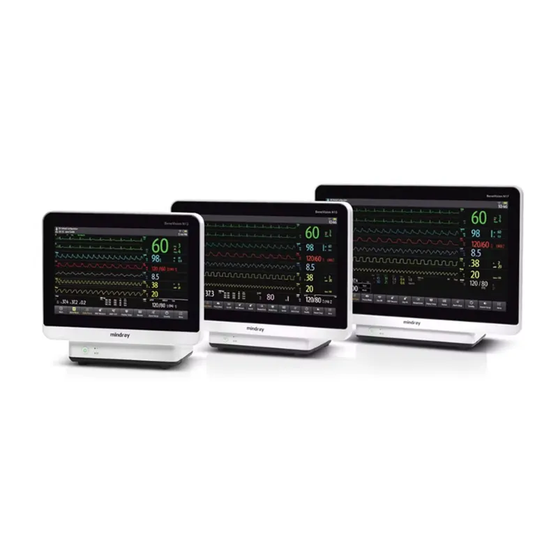 Patient Monitor 1