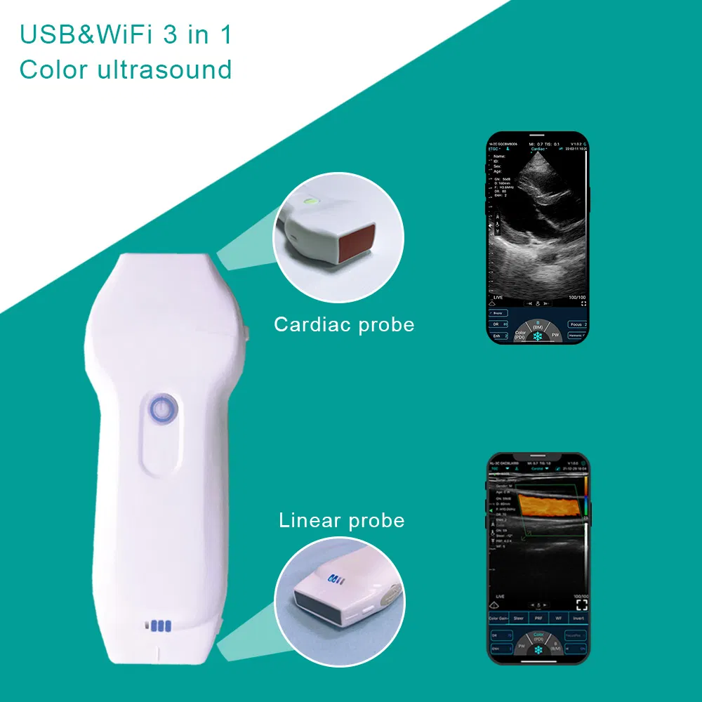 Wireless Ultrasound Probe for Convenient Patient Monitoring Solutions C10XL