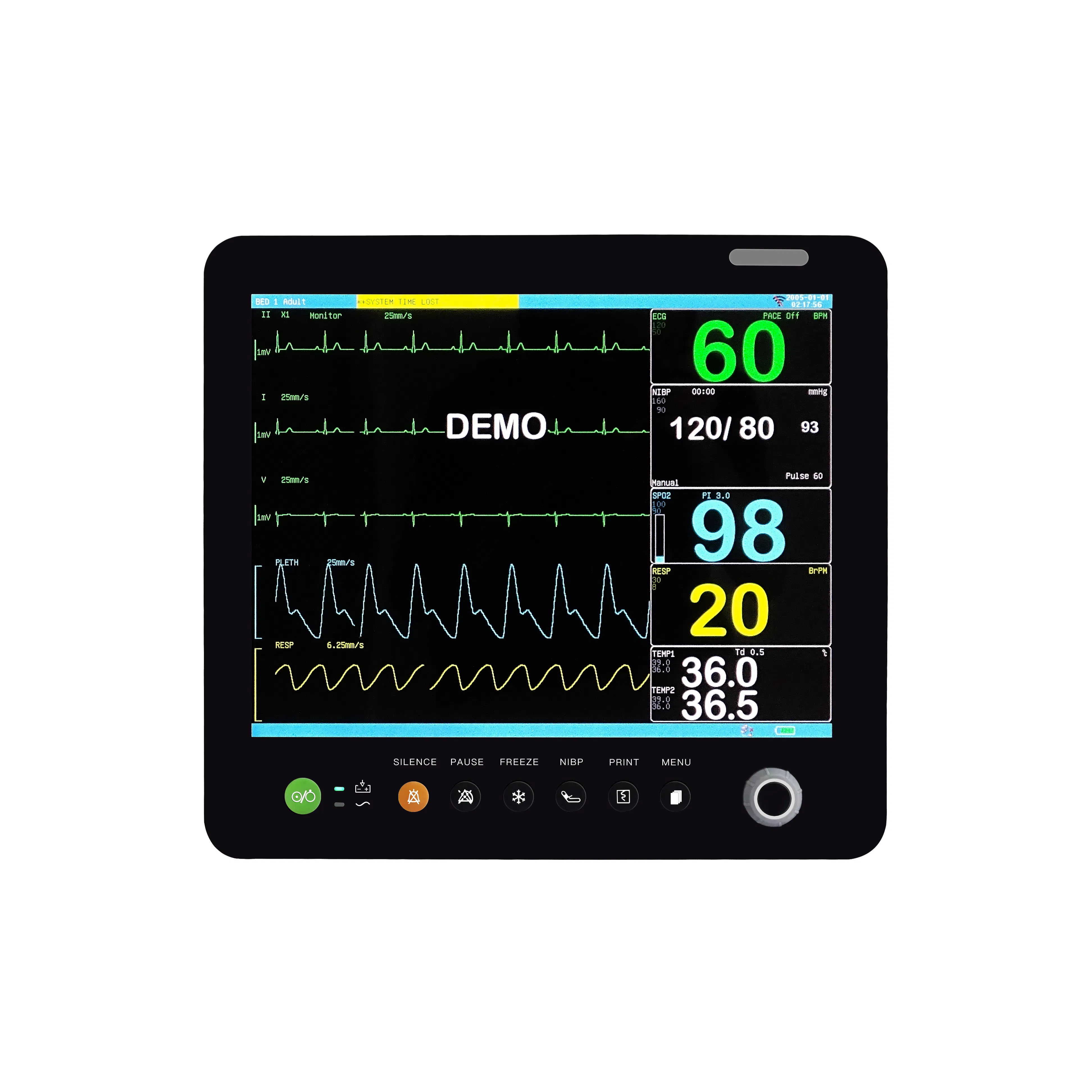 Mecan Excellent Quality Telemedicine Telehealth Remote Monitoring Devices Emergency Ambulance Multi-Parameter Patient Monitor