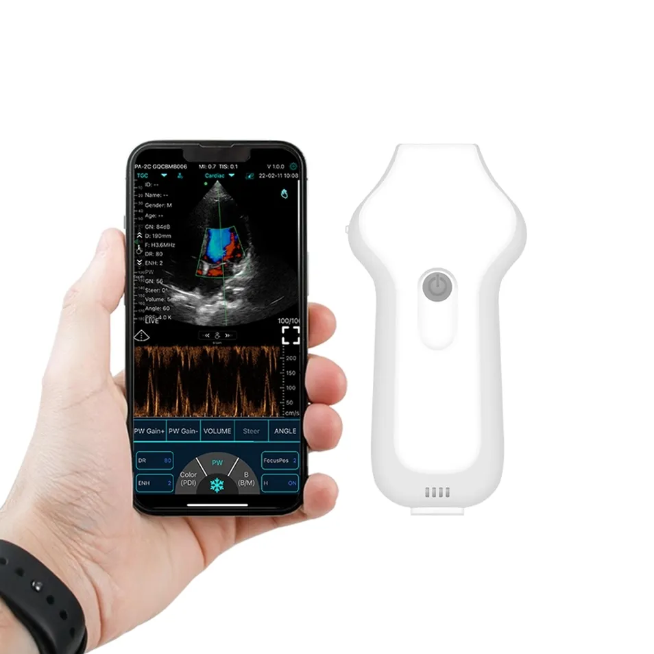 Ultrasound Performance 1