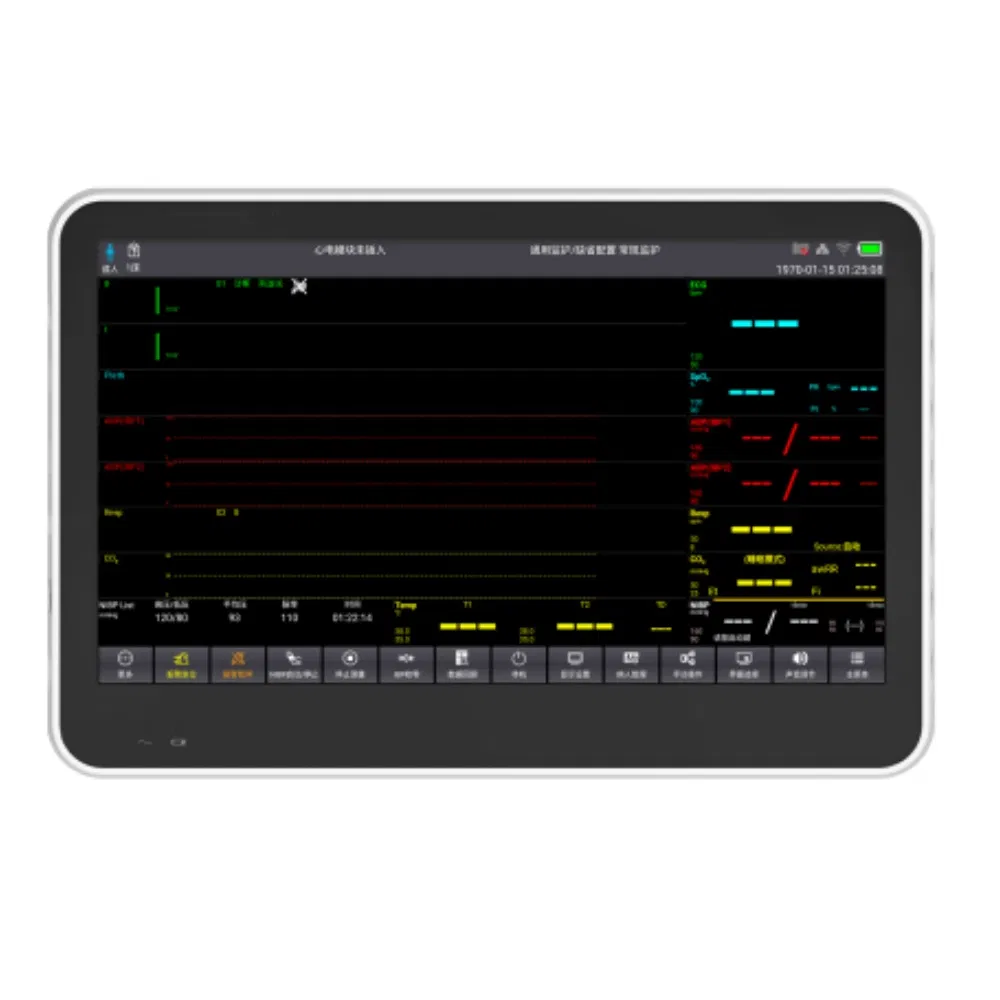 Advanced Smart Vital Sign Monitor for Remote Health Tracking