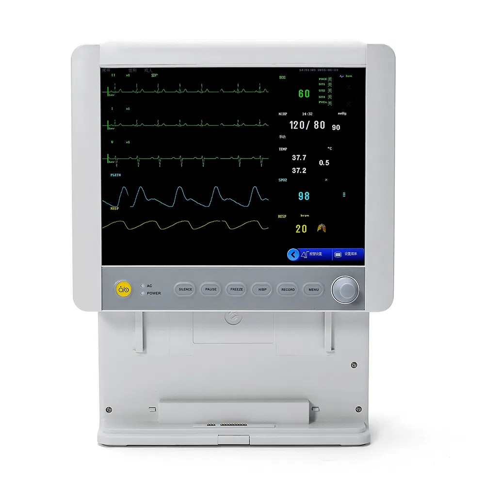 ECG Resp Monitoring